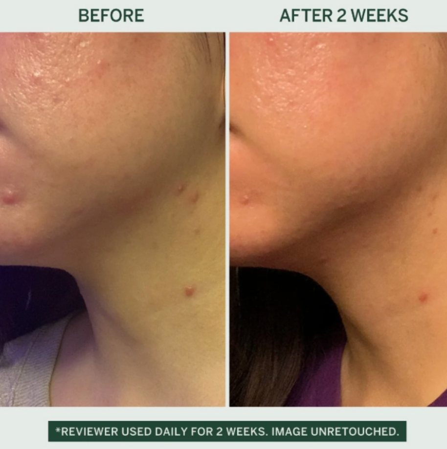 Fermented Barrier Cream | Hydrating Skin Repair